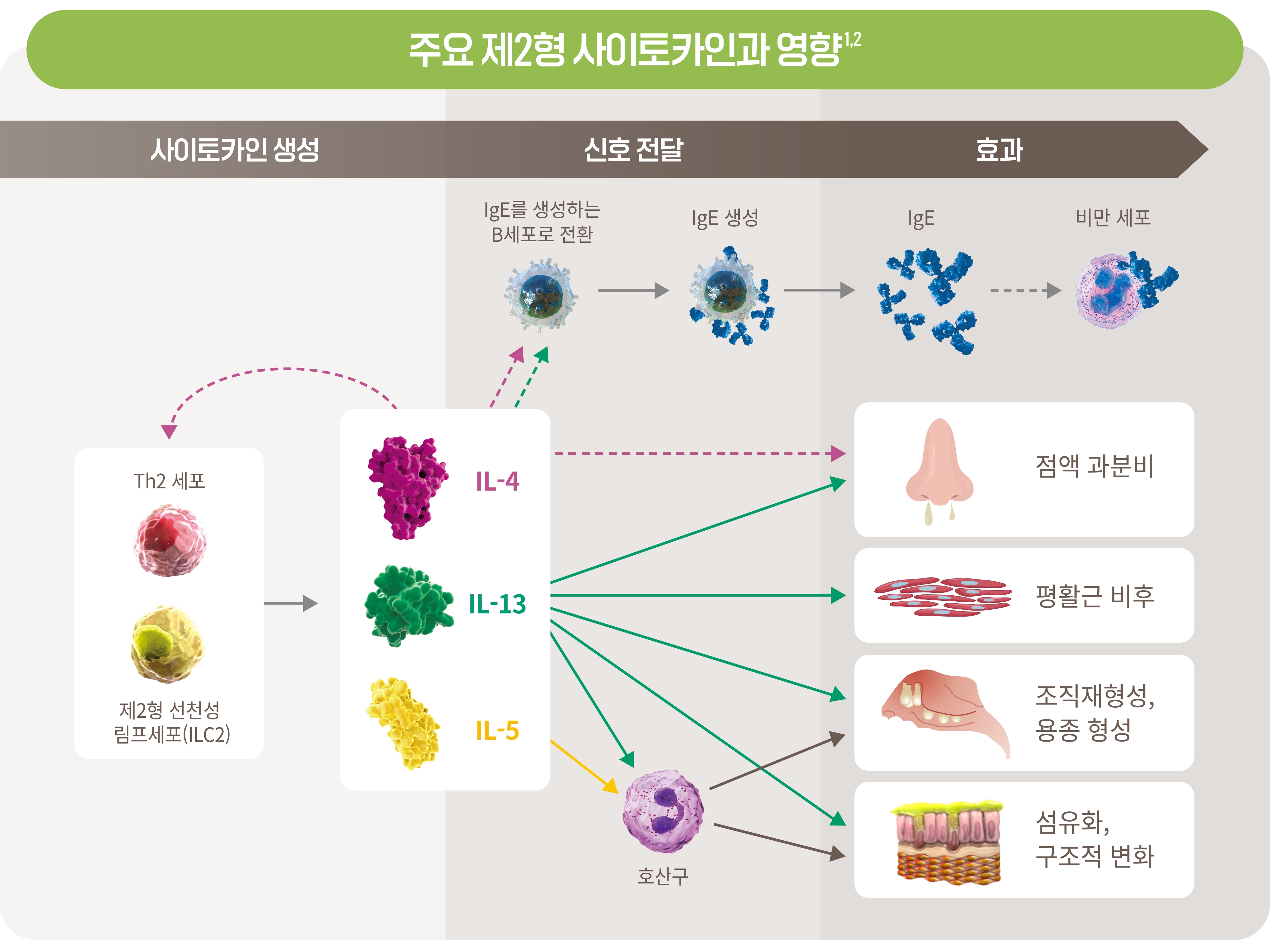 비부비동염이란?