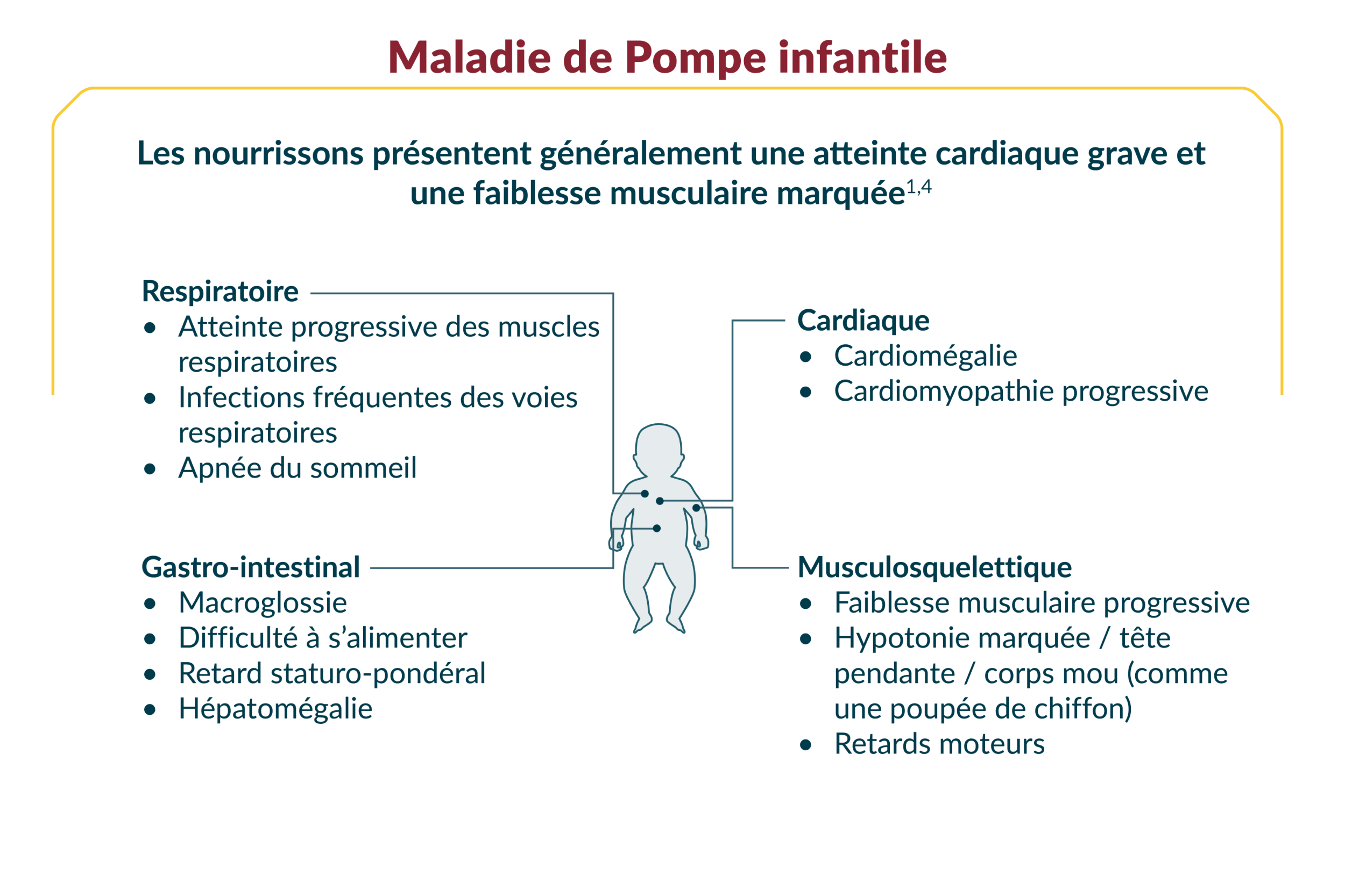 Représentation de l’organisme d’un nourrisson et d’un adulte indiquant les symptômes de la MP infantile et de la MP à début tardif, respectivement. Cliquer sur « Texte intégral de l’image » pour obtenir une description complète.