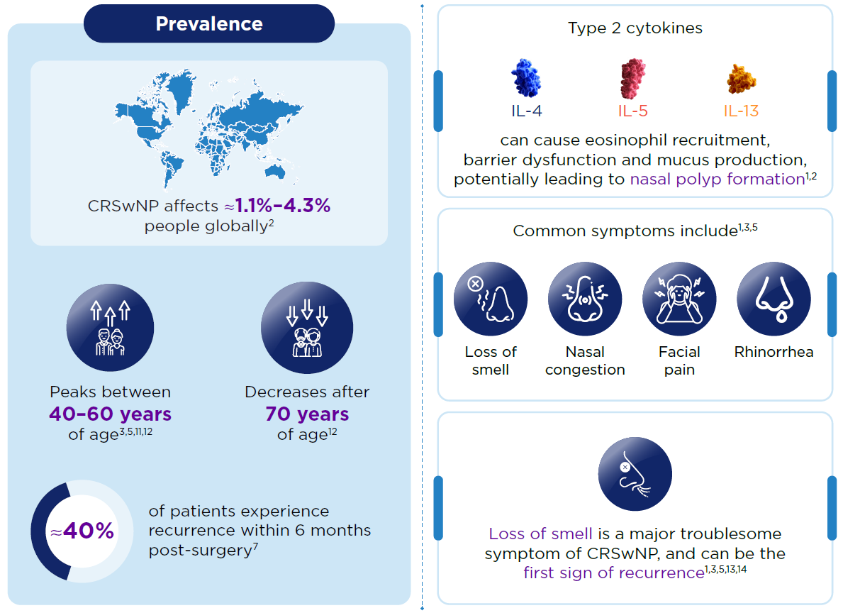 Type 2 inflammation plays a central role in CRSwNP, affecting up to 87% patients