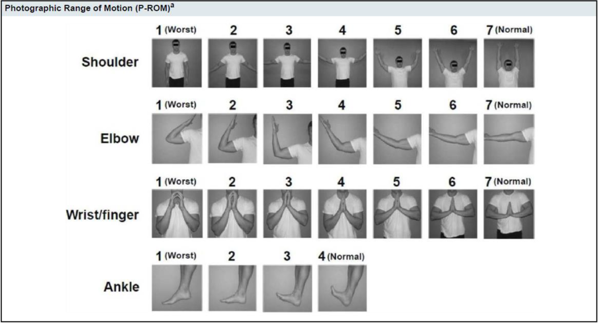 joints-score1