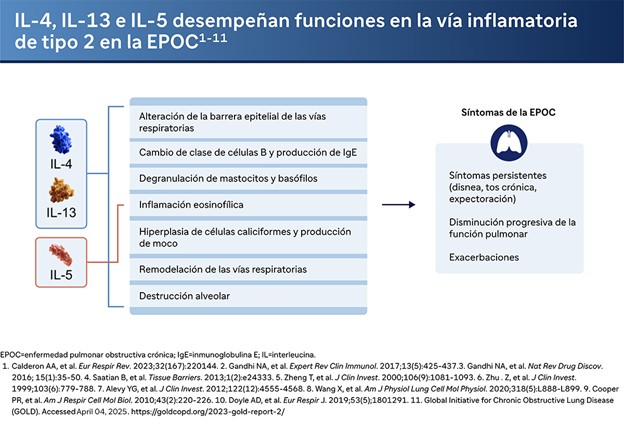 IL-4, IL-13 e IL-5 desempeñan funciones en la vía inflamatoria de tipo 2 en la EPOC