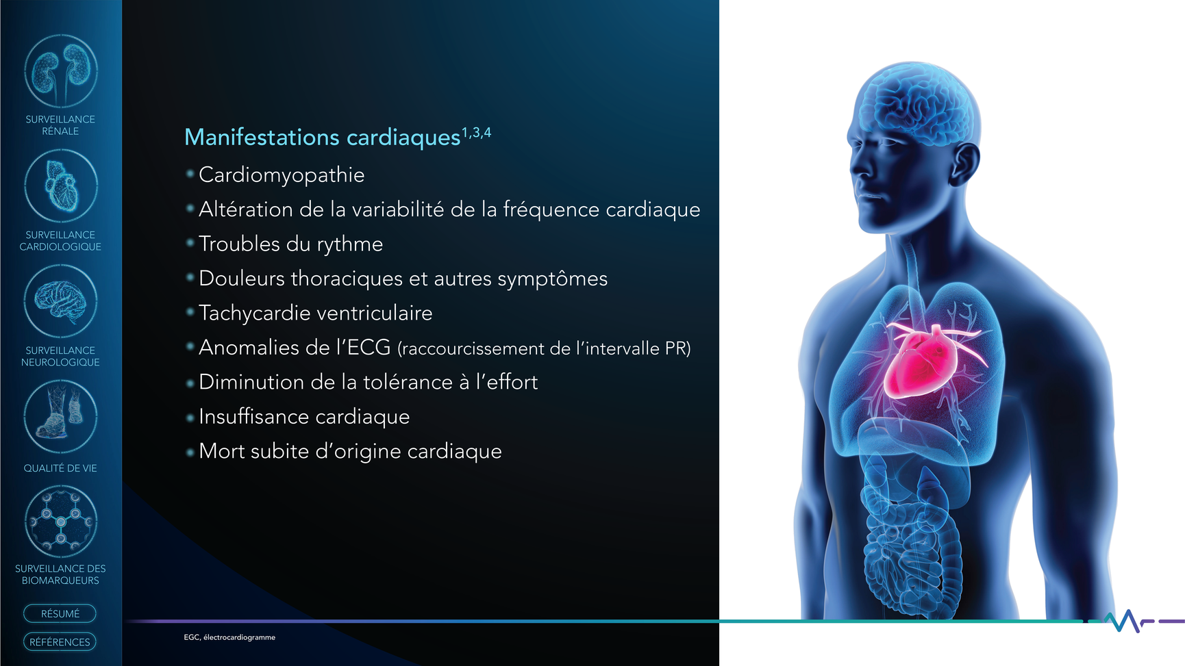 Slide_4