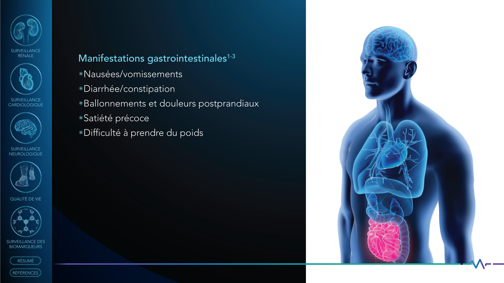 Slide_6