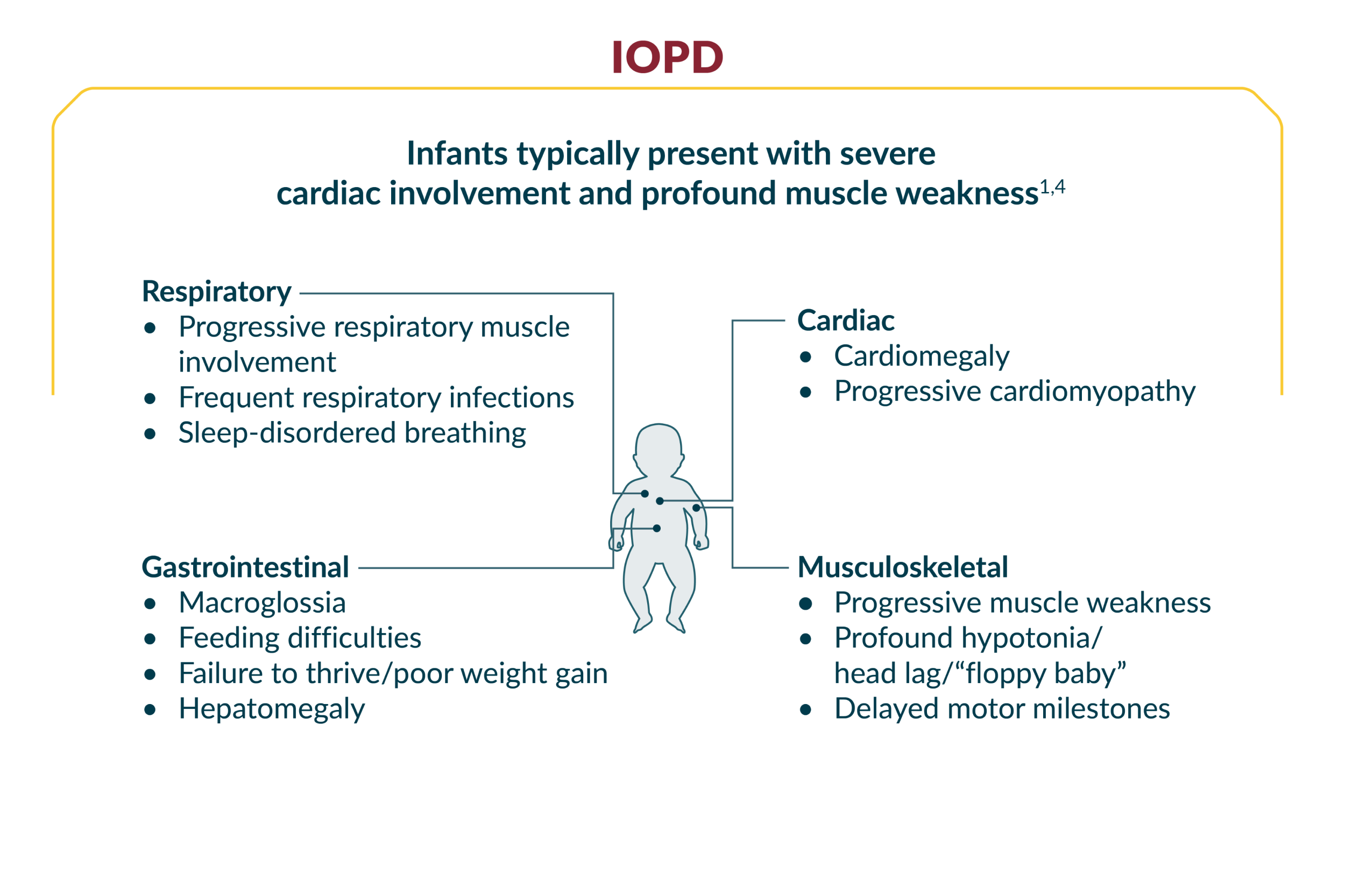 Body of infant and adult, showing symptoms of IOPD and LOPD, respectively. Click on Image full text for full description.