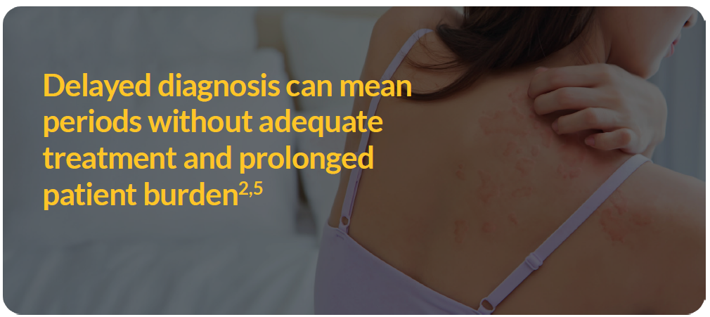 early-diagnosis