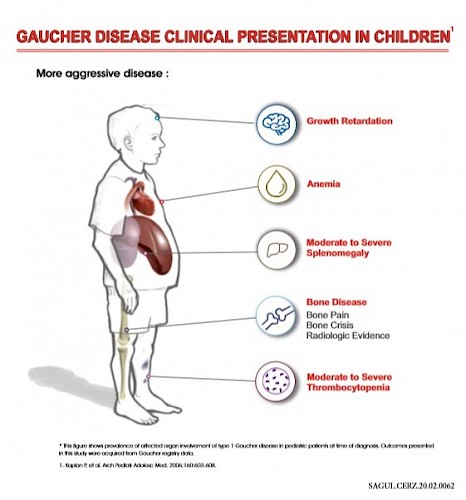 How To Diagnose Gaucher Disease