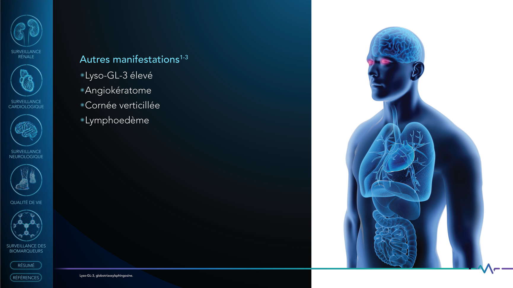 Slide_7