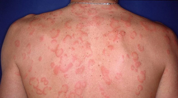 derma-csu