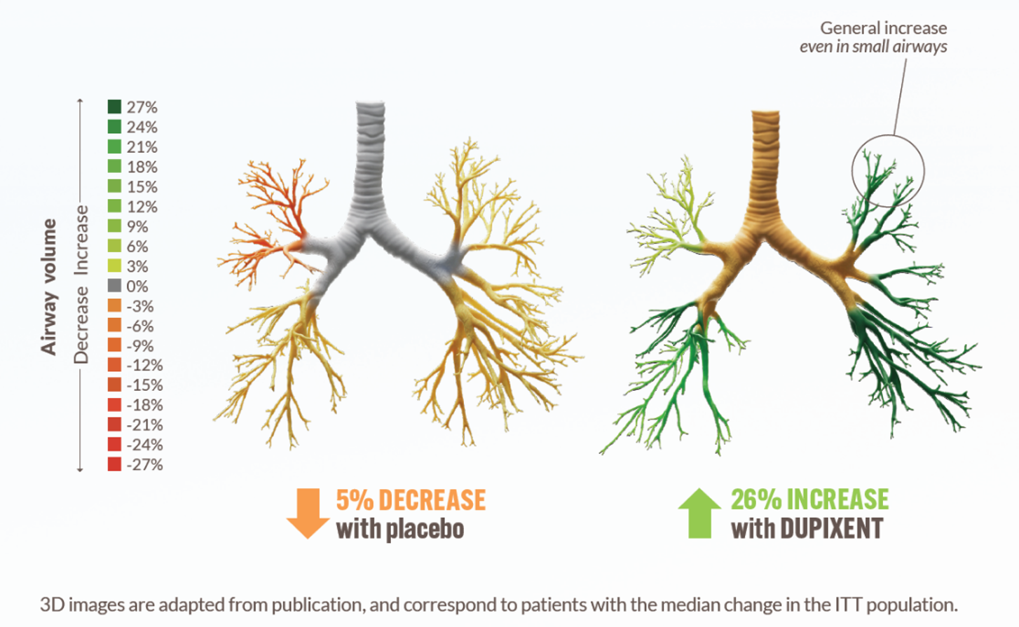 Graph3_airway volume