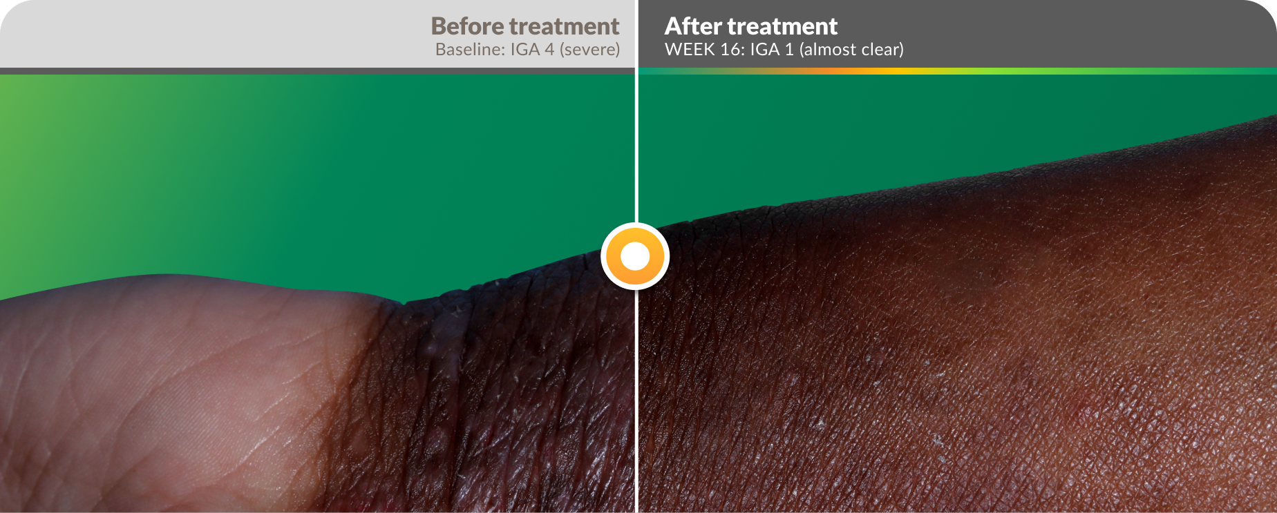 efficacy-before-after-wrist
