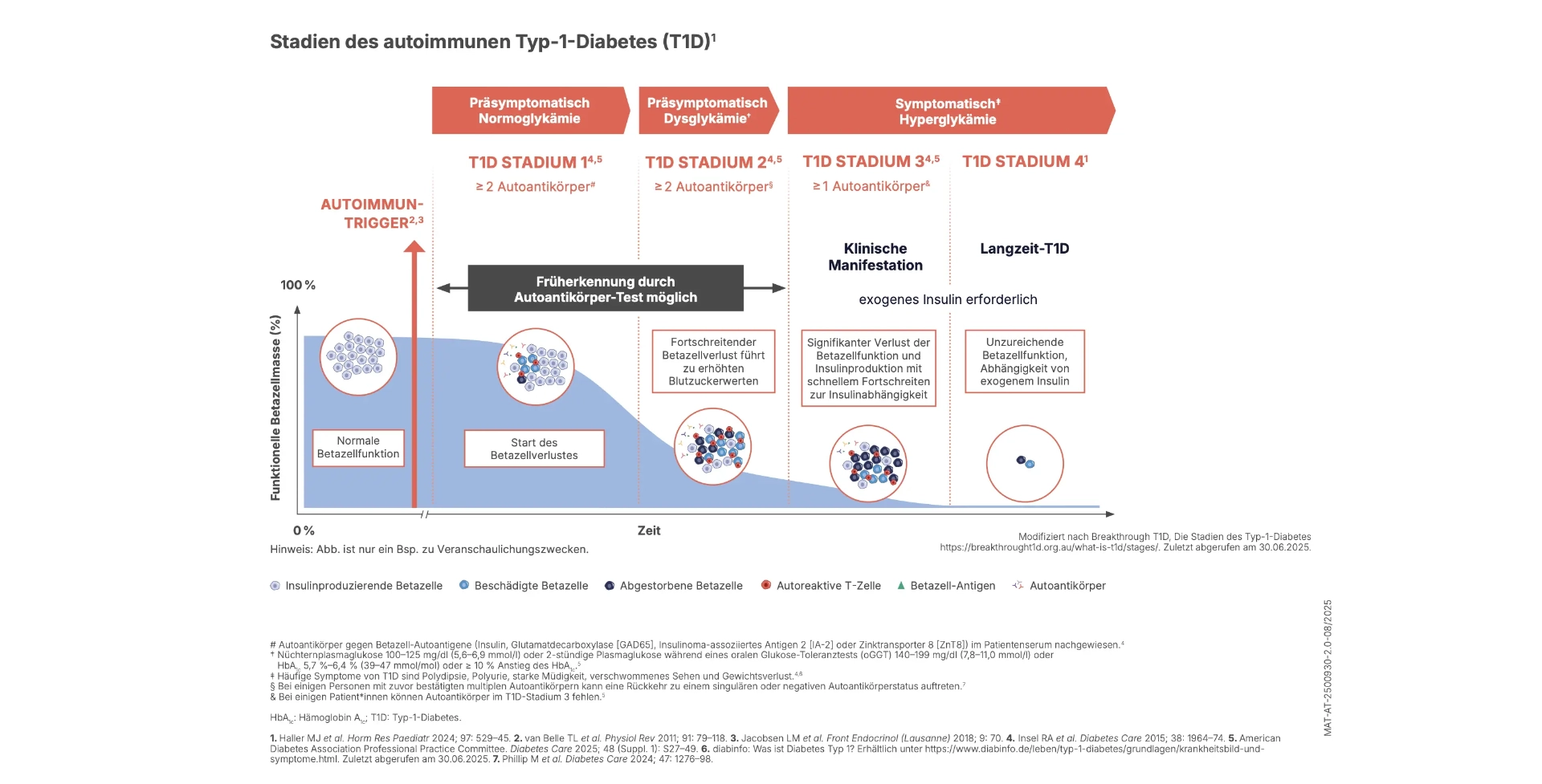 Infografik mit dem Titel "Auotimmuner Typ-1-Diabetes, von unsichtbar zu unübersehbar - ein Autoimmunprozess in Phasen". Infografik zum autoimmunen Typ-1-Diabetes, die den Krankheitsverlauf in drei Phasen darstellt: von präsymptomatischer Normoglykämie (Stadium 1) über präsymptomatische Dysglykämie (Stadium 2) bis zur symptomatischen Hyperglykämie (Stadium 3). Die Grafik zeigt den progressiven Verlust der Betazellenfunktion von 100% auf 0%, die Zunahme der Autoantikörper und den Zeitpunkt, ab dem exogenes Insulin erforderlich wird. Illustriert werden intakte, beschädigte und abgestorbene Betazellen sowie autoreaktive T-Zellen, Betazell- Antigene und Autoantikörper. Die Abbildung dient Veranschaulichungszwecken und basiert auf wissenschaftlicher Literatur.