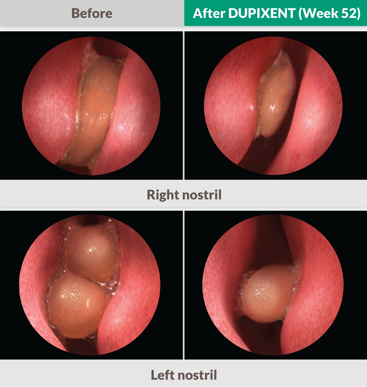 Endoscopy