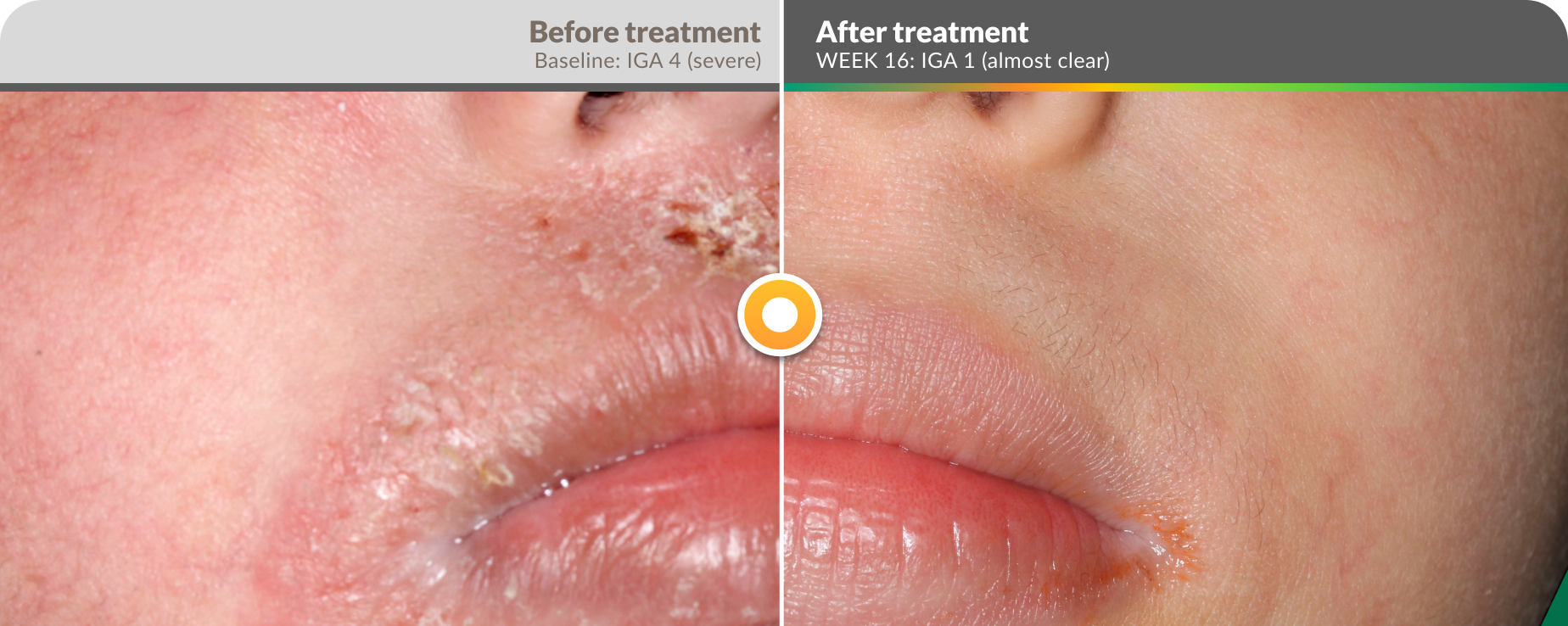 efficacy-before-after-mouth