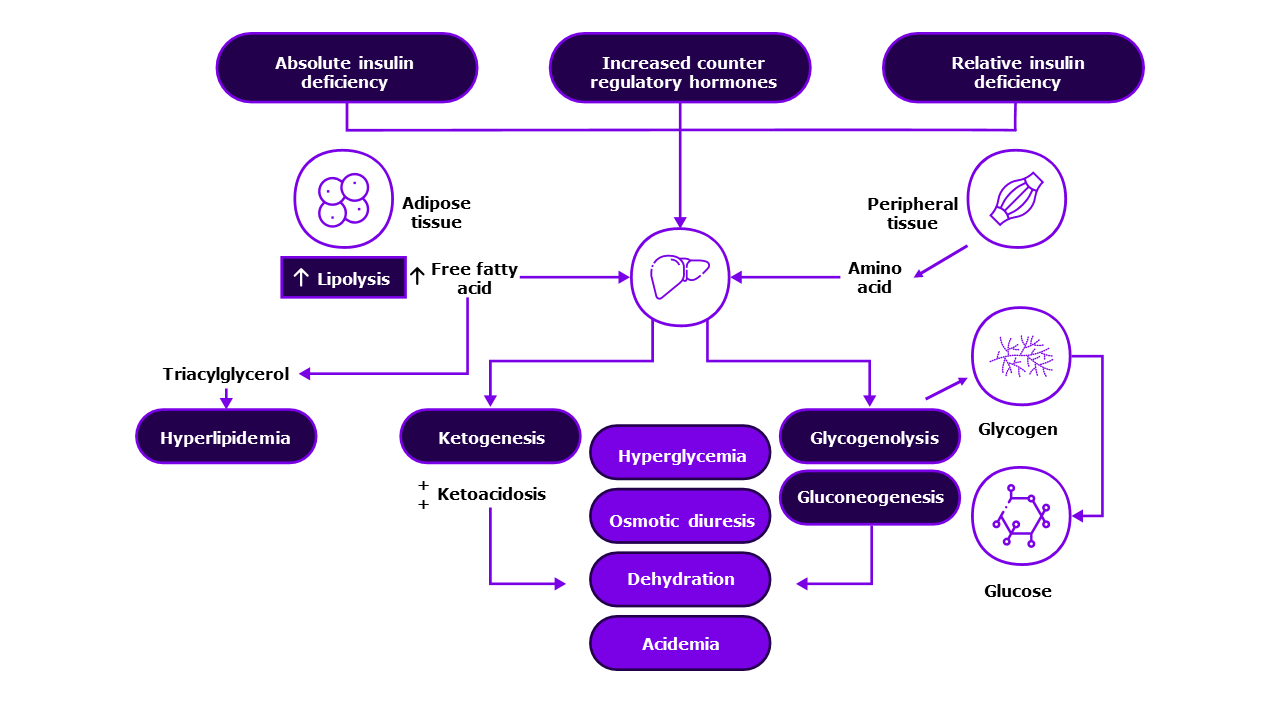 Pathogenesis-DKA