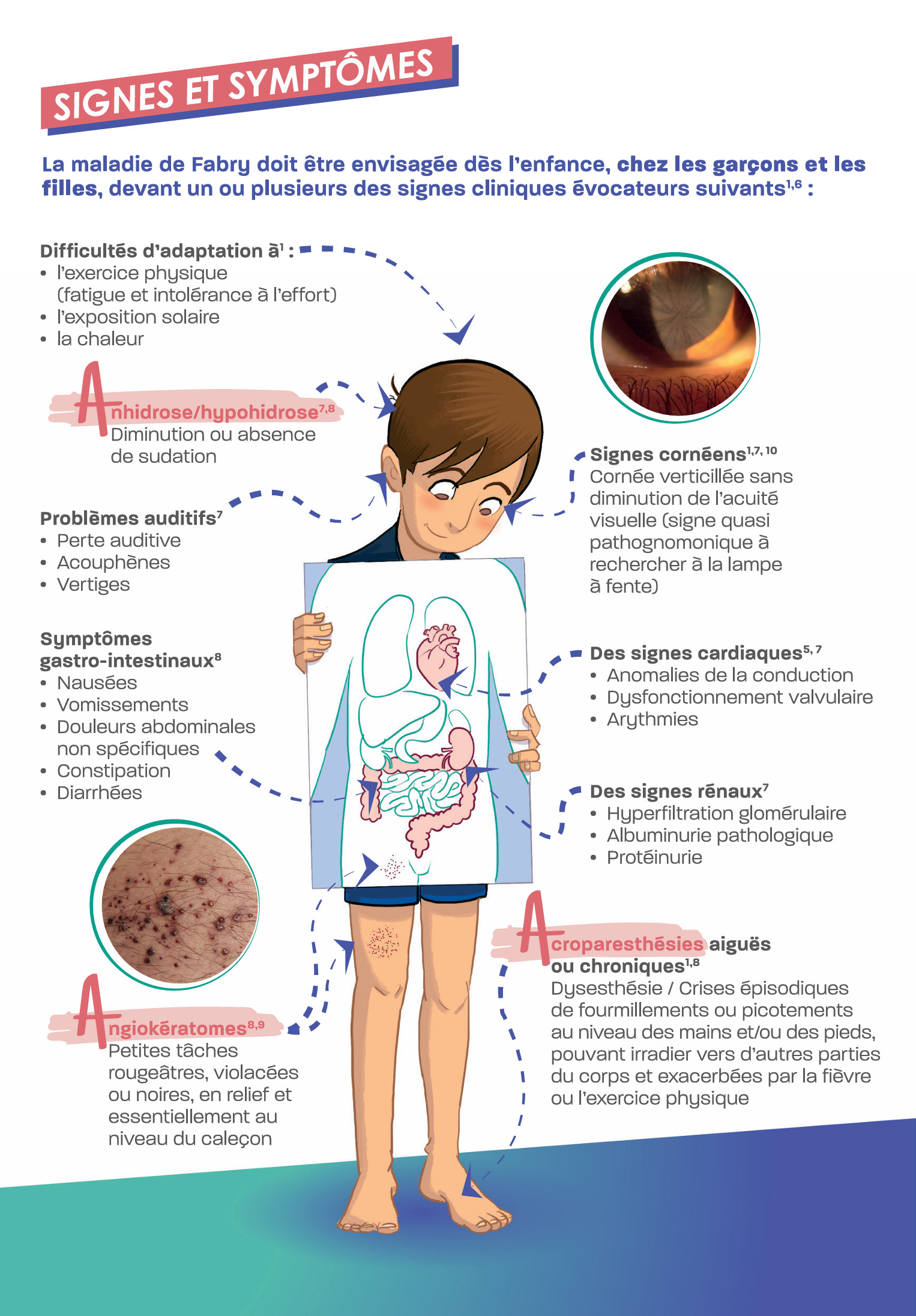 brochure-maladie-fabry-pediatrie-img3