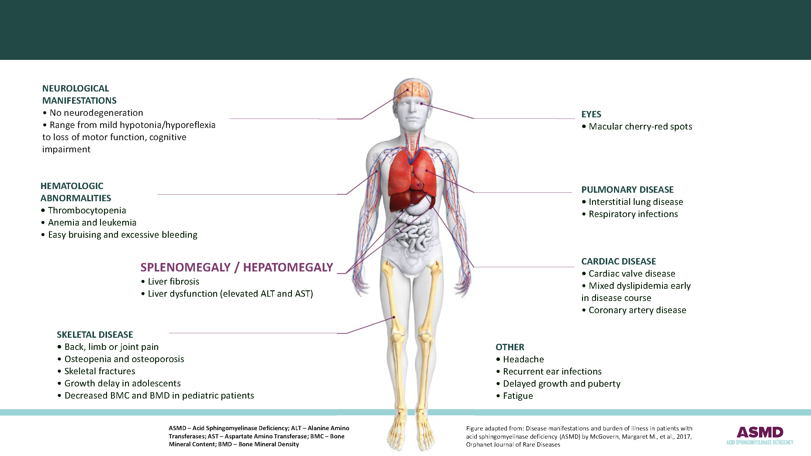 Body ASMD Digital HCP