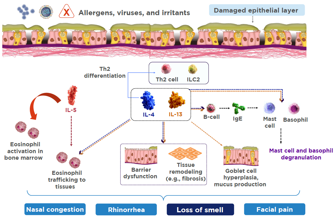 Smell loss is associated with type 2 inflammation