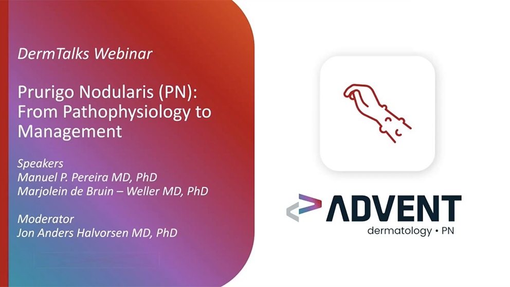 Prurigo Nodularis: From Pathophysiology to Management