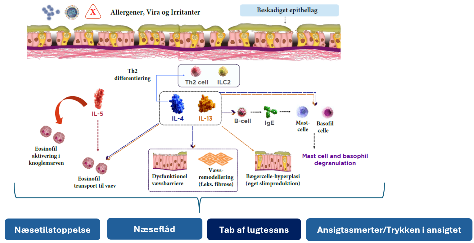 Smell loss is associated with type 2 inflammation